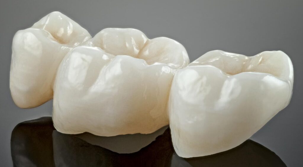 metal free ceramic dental crowns e1694600595601